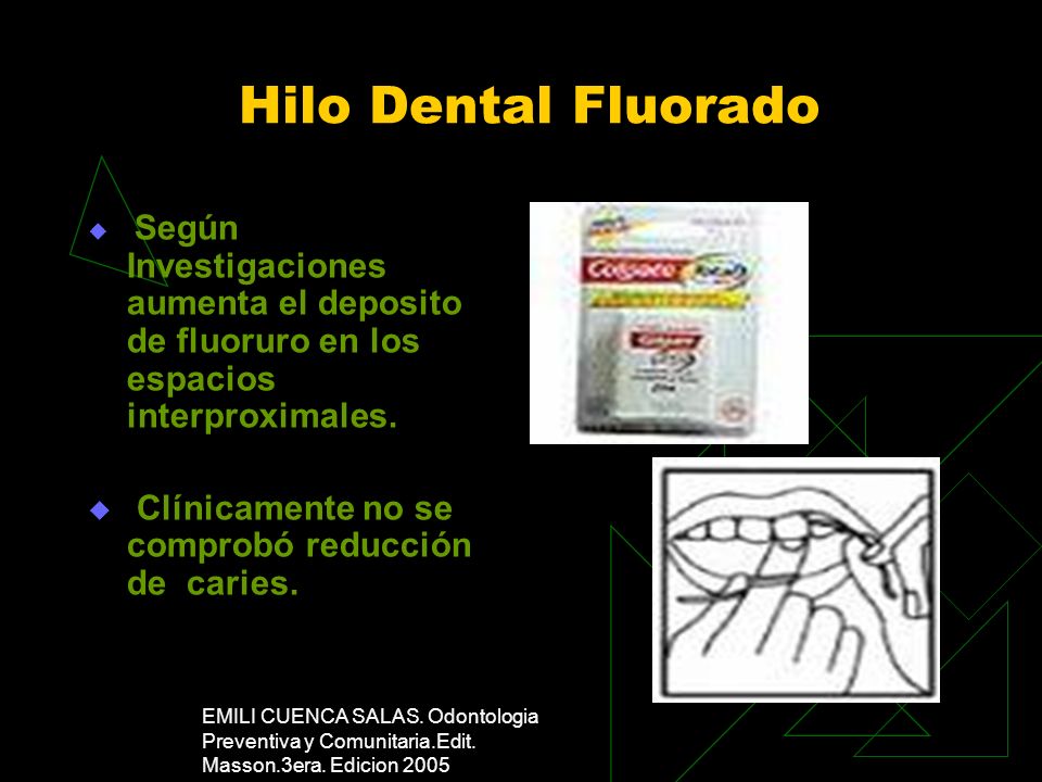 Hilo Dental Fluorado Clínicamente no se comprobó reducción de caries.