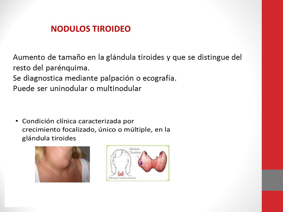 NODULOS TIROIDEO Aumento de tamaño en la glándula tiroides y que se distingue del. resto del parénquima.
