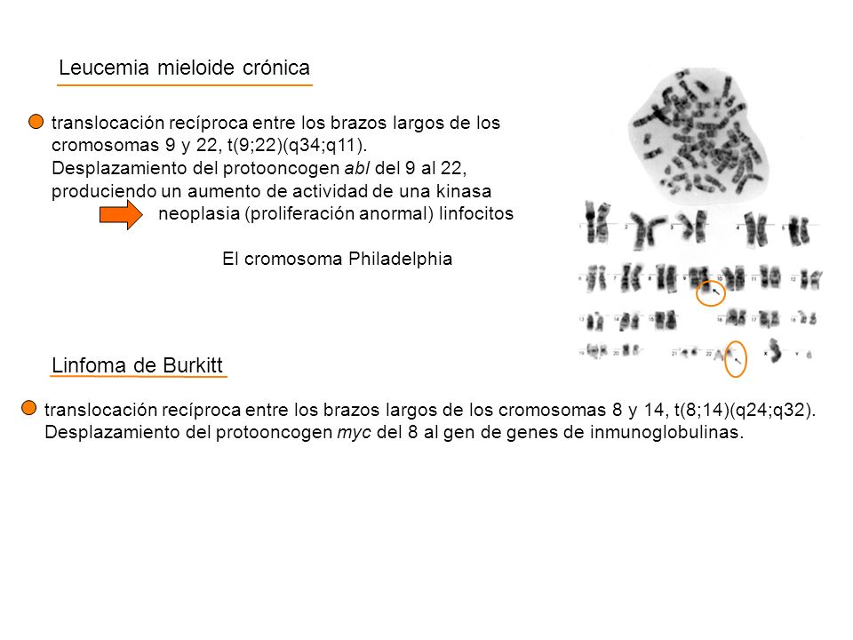 Leucemia mieloide crónica