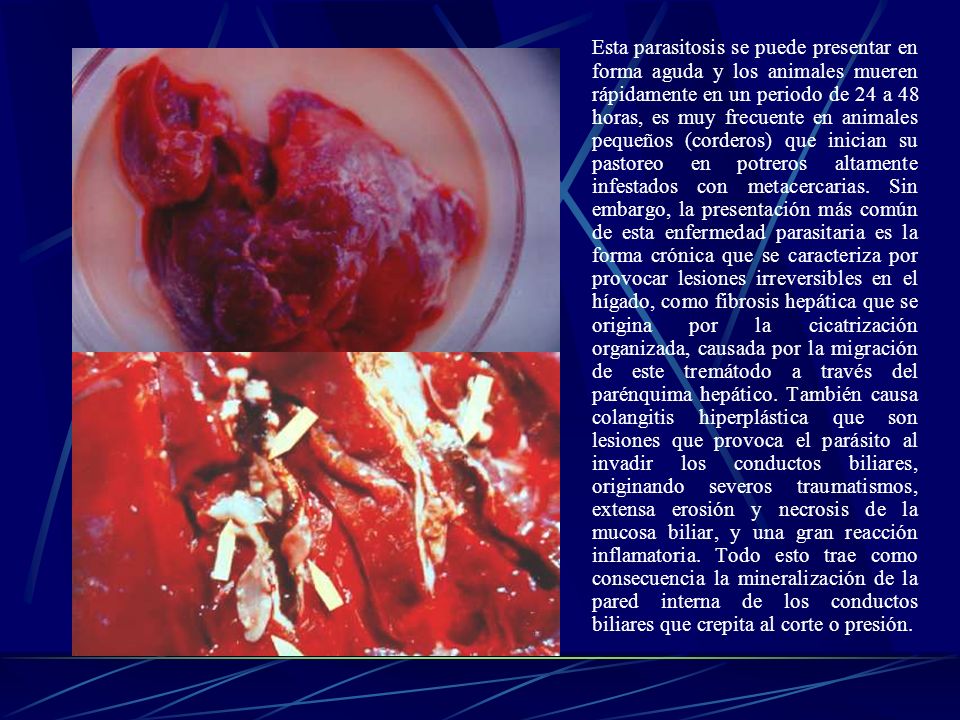 Esta parasitosis se puede presentar en forma aguda y los animales mueren rápidamente en un periodo de 24 a 48 horas, es muy frecuente en animales pequeños (corderos) que inician su pastoreo en potreros altamente infestados con metacercarias.