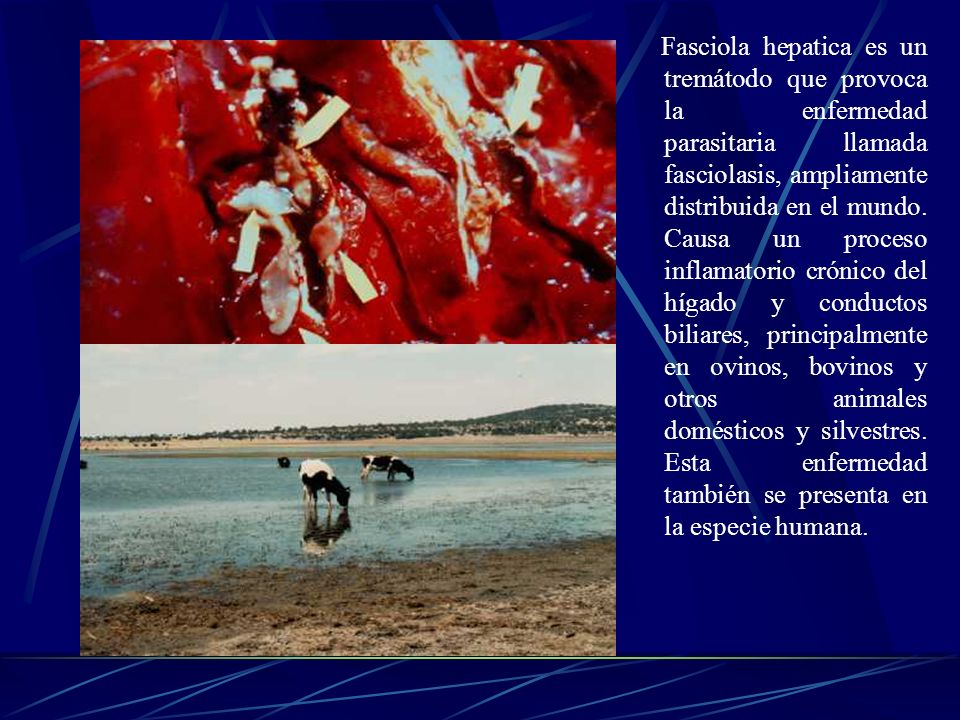 Fasciola hepatica es un tremátodo que provoca la enfermedad parasitaria llamada fasciolasis, ampliamente distribuida en el mundo.