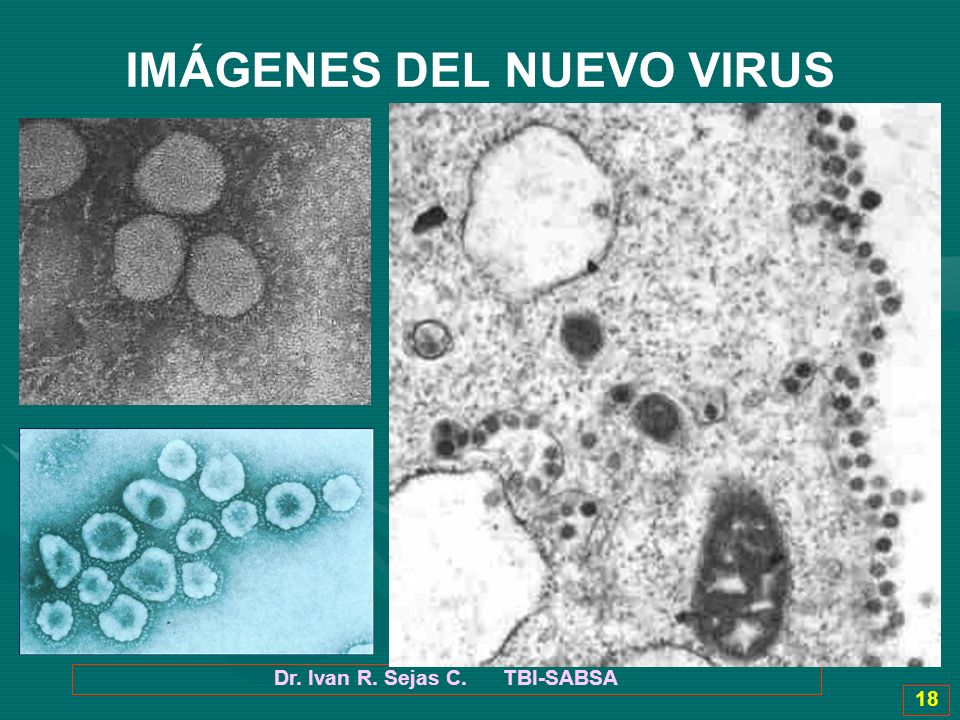 IMÁGENES DEL NUEVO VIRUS Dr. Ivan R. Sejas C. TBI-SABSA