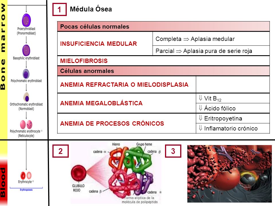 1 2 3 Médula Ósea Pocas células normales INSUFICIENCIA MEDULAR