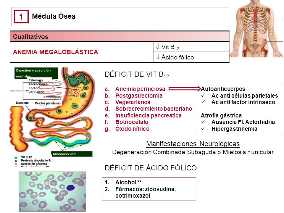 1 Médula Ósea DÉFICIT DE VIT B12 Manifestaciones Neurológicas