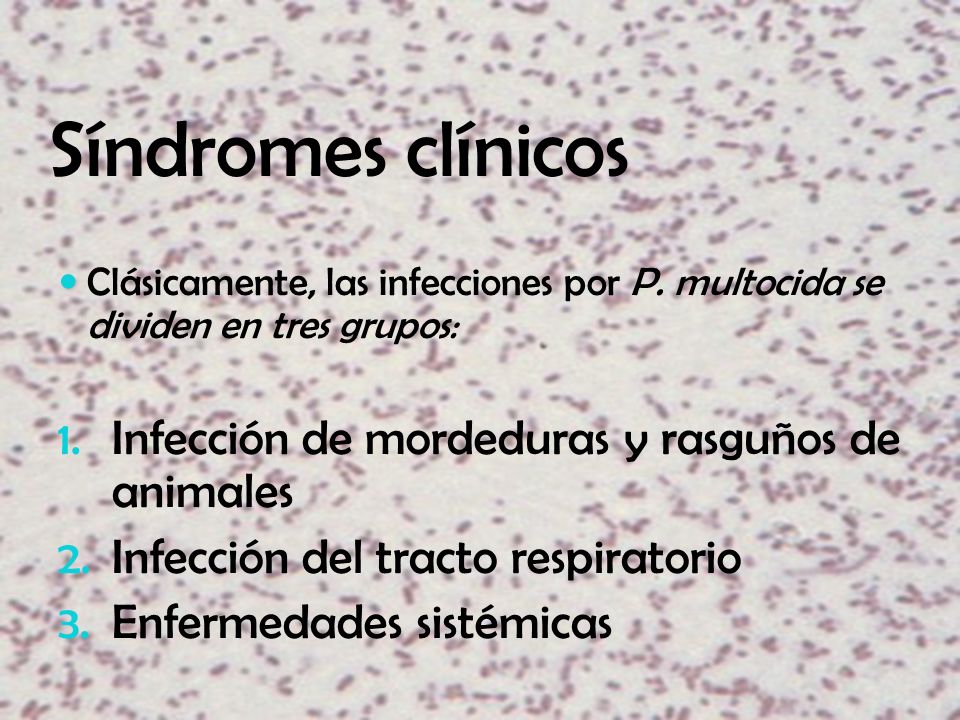 Síndromes clínicos Infección de mordeduras y rasguños de animales