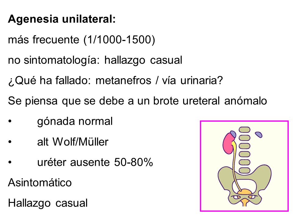 Agenesia unilateral: más frecuente (1/ ) no sintomatología: hallazgo casual. ¿Qué ha fallado: metanefros / vía urinaria