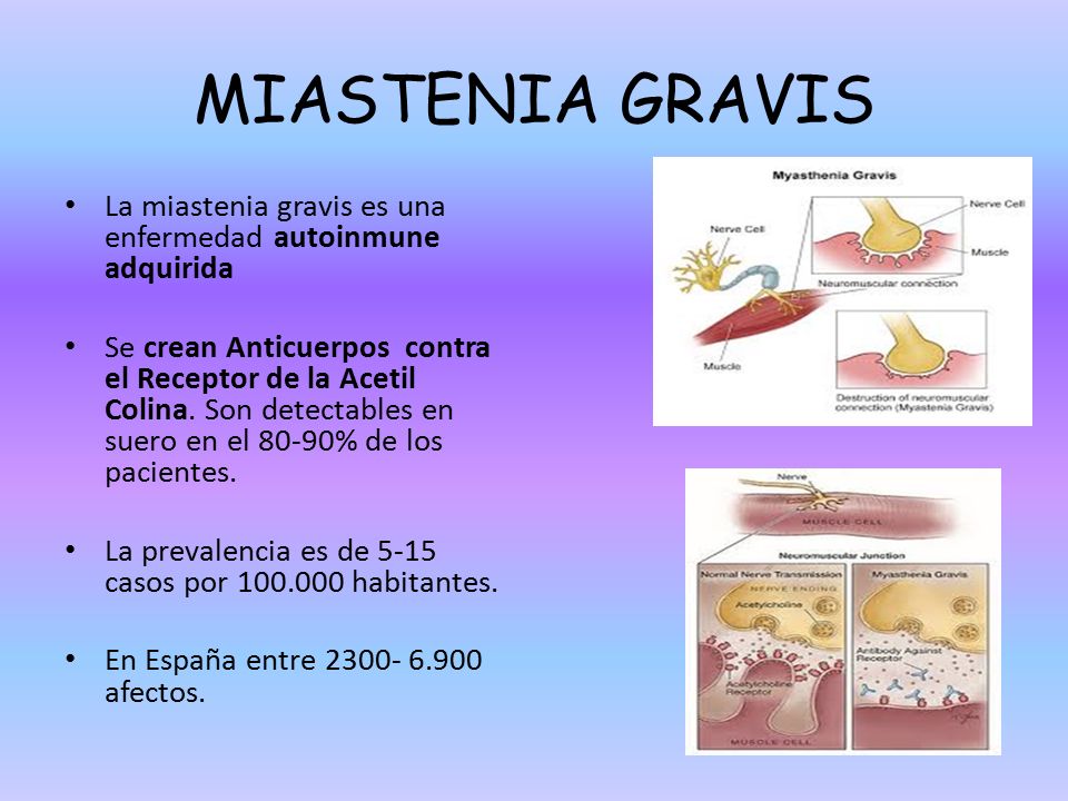 MIASTENIA GRAVIS La miastenia gravis es una enfermedad autoinmune adquirida.
