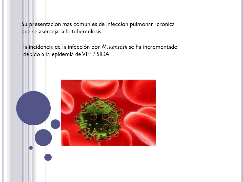 Su presentacion mas comun es de infeccion pulmonar cronica que se asemeja a la tuberculosis.