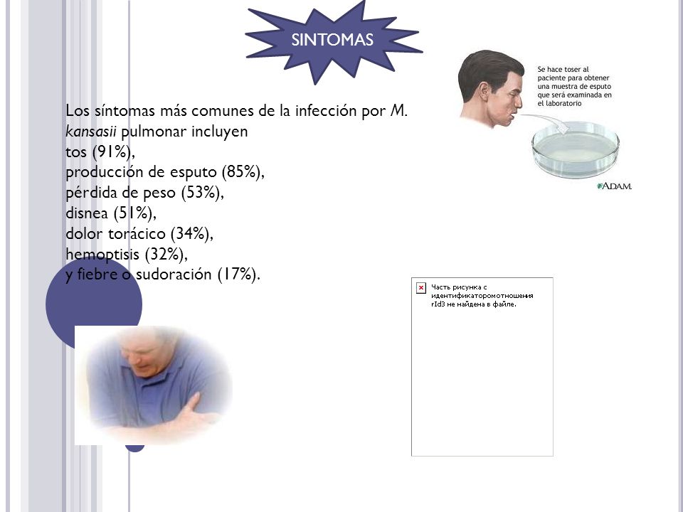 SINTOMAS Los síntomas más comunes de la infección por M. kansasii pulmonar incluyen. tos (91%), producción de esputo (85%),