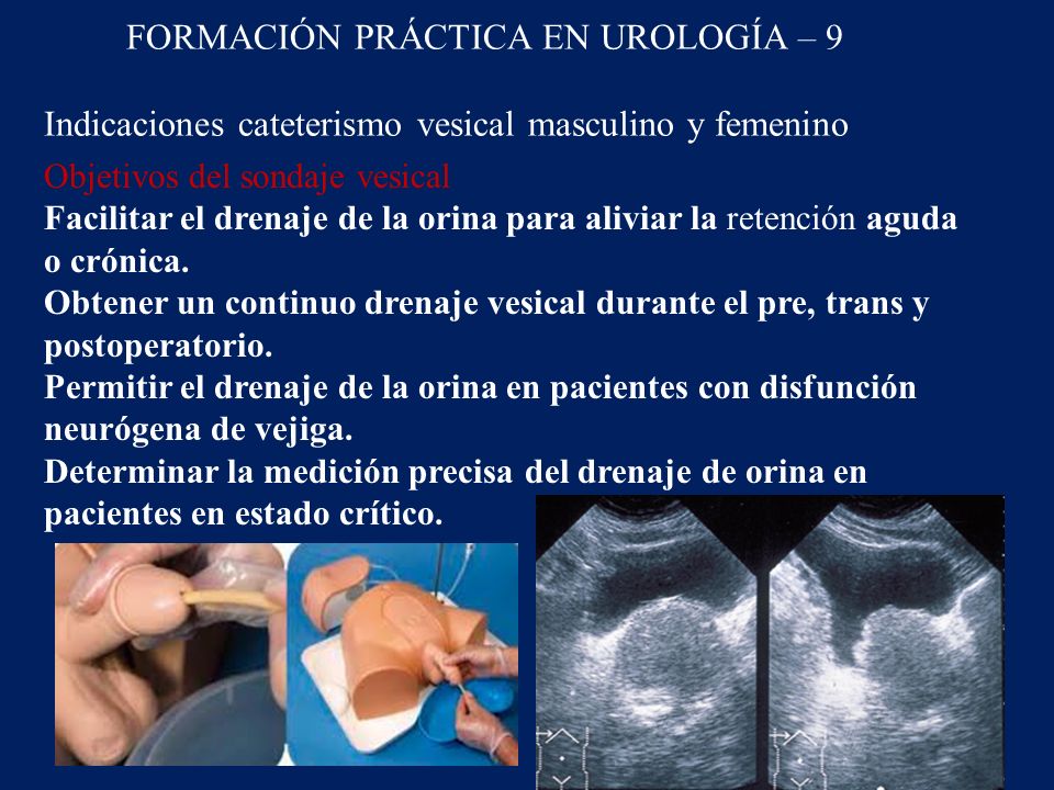 FORMACIÓN PRÁCTICA EN UROLOGÍA – 9 Indicaciones cateterismo vesical masculino y femenino