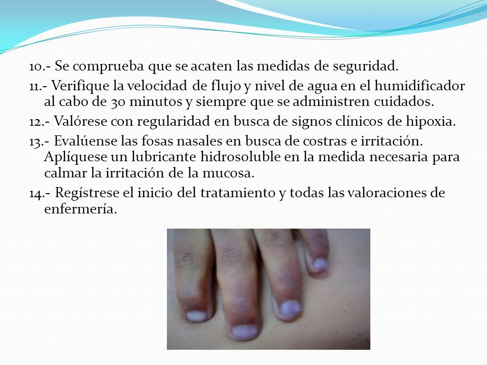 10.- Se comprueba que se acaten las medidas de seguridad.