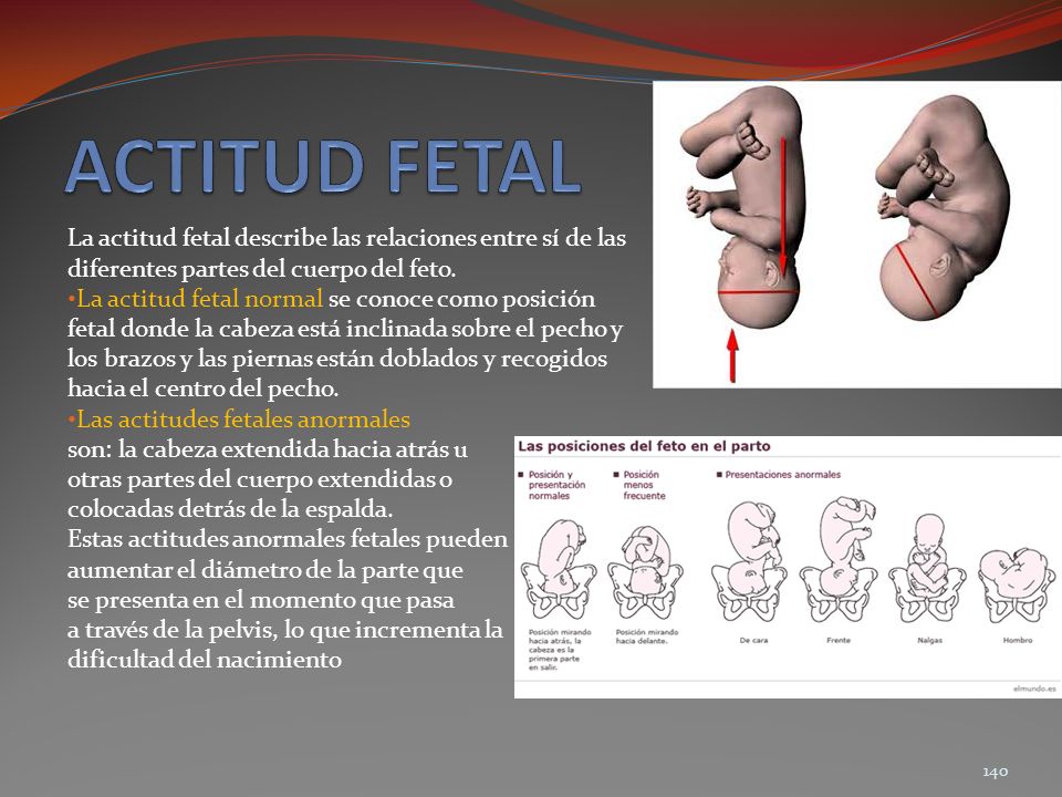 ACTITUD FETAL La actitud fetal describe las relaciones entre sí de las