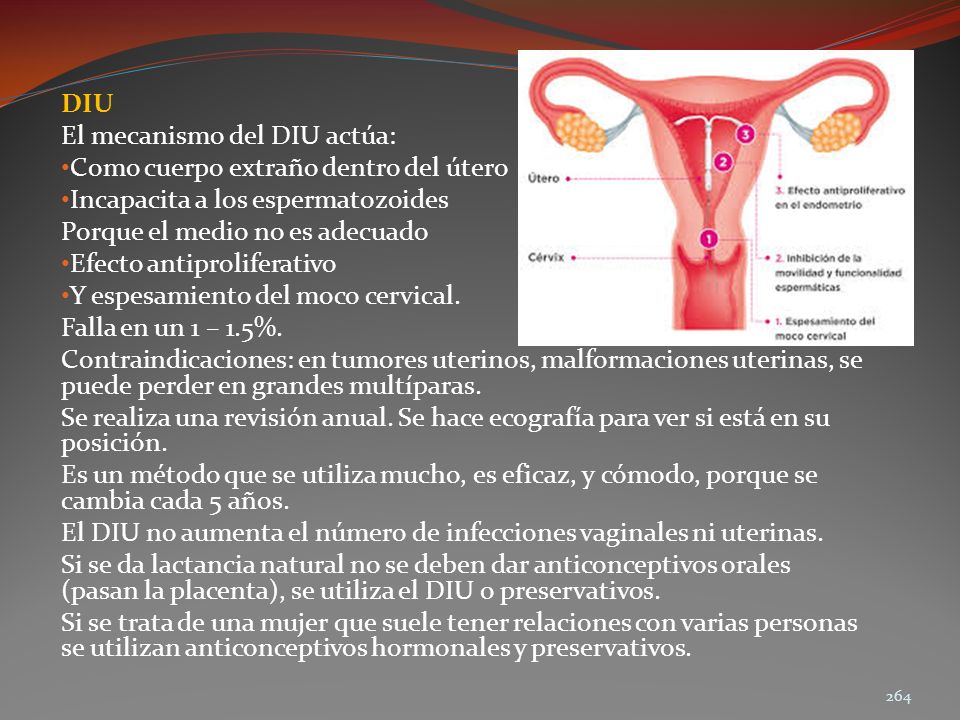 DIU El mecanismo del DIU actúa: Como cuerpo extraño dentro del útero. Incapacita a los espermatozoides.