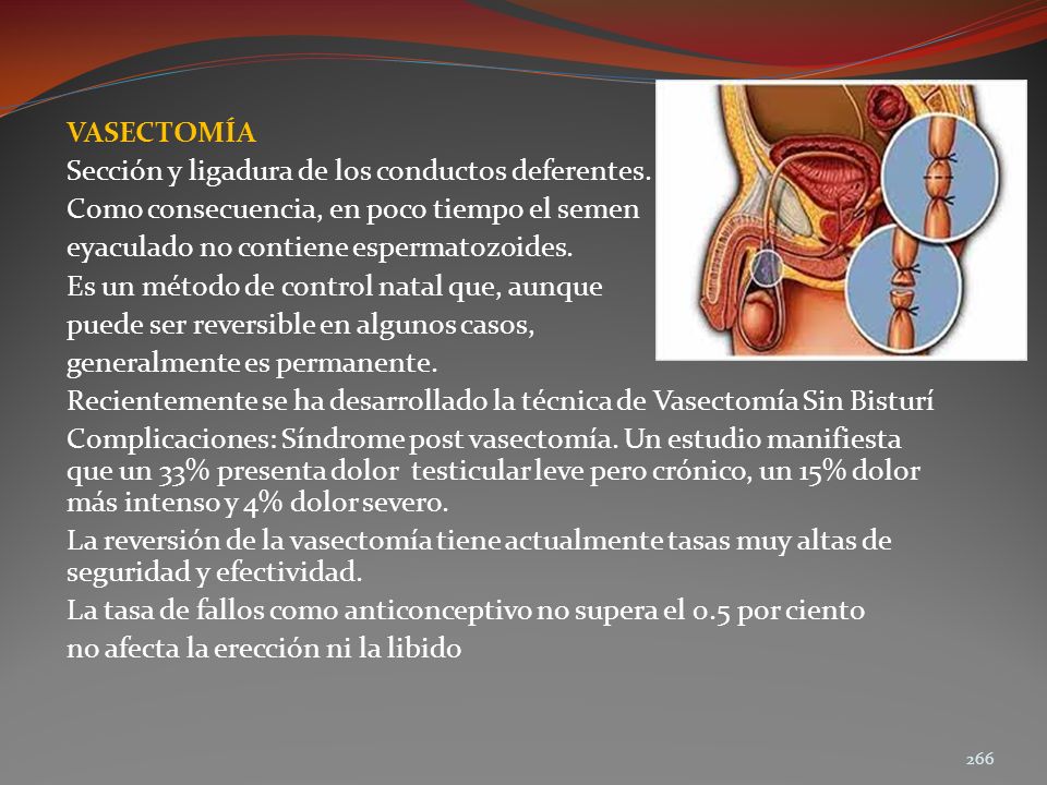 VASECTOMÍA Sección y ligadura de los conductos deferentes. Como consecuencia, en poco tiempo el semen.