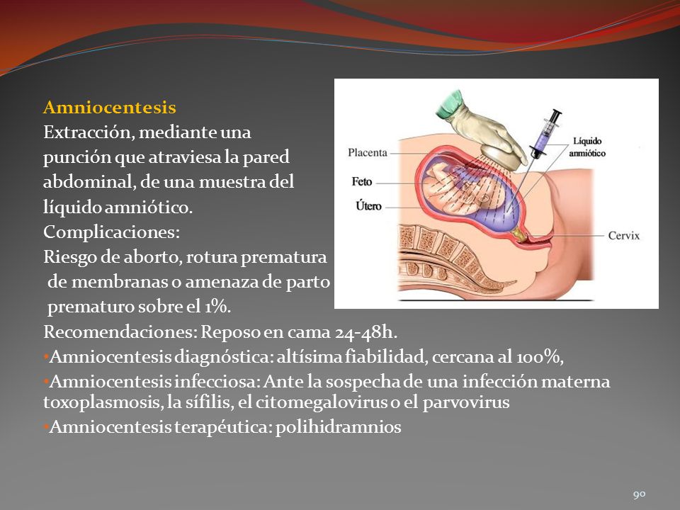 Amniocentesis Extracción, mediante una. punción que atraviesa la pared. abdominal, de una muestra del.
