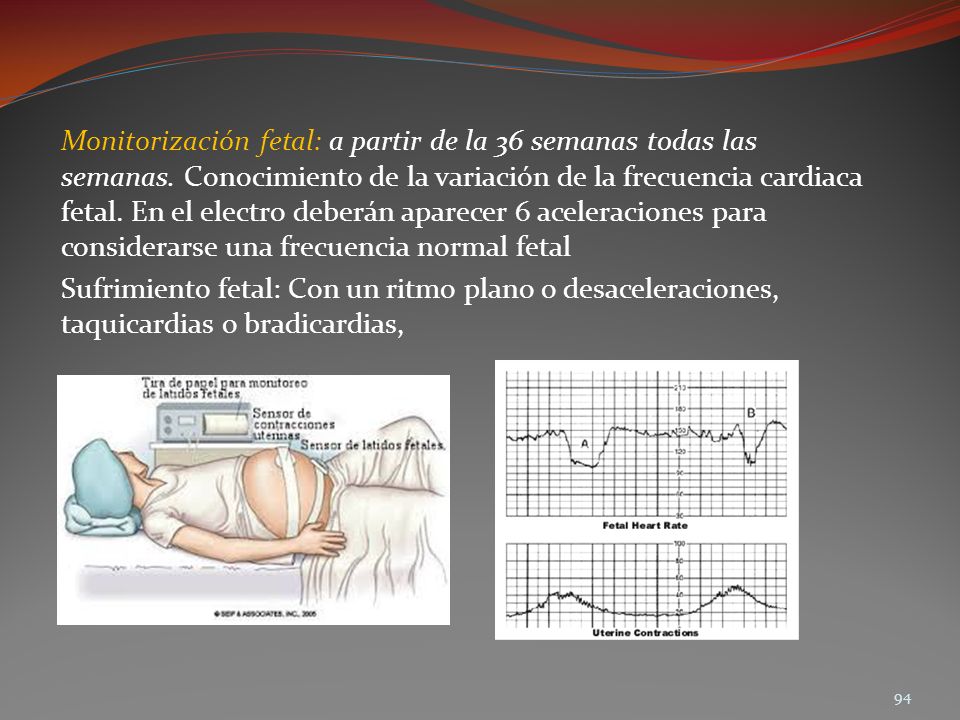 Monitorización fetal: a partir de la 36 semanas todas las semanas