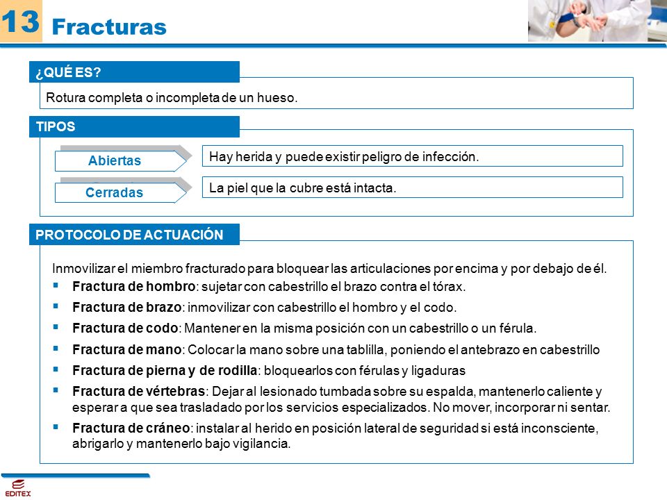 Fracturas ¿QUÉ ES Rotura completa o incompleta de un hueso. TIPOS