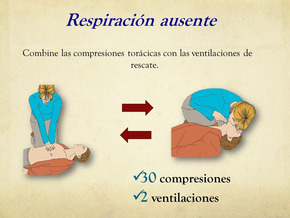 Combine las compresiones torácicas con las ventilaciones de rescate.