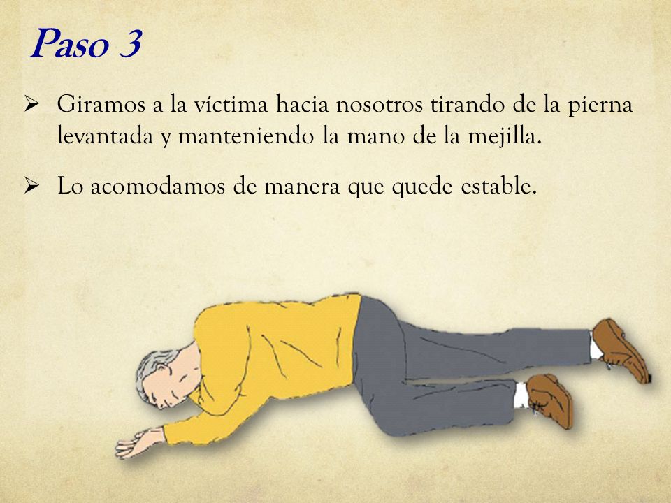 Paso 3 Giramos a la víctima hacia nosotros tirando de la pierna levantada y manteniendo la mano de la mejilla.
