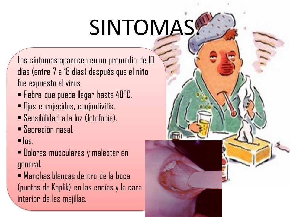 SINTOMAS. Los síntomas aparecen en un promedio de 10 días (entre 7 a 18 días) después que el niño fue expuesto al virus.