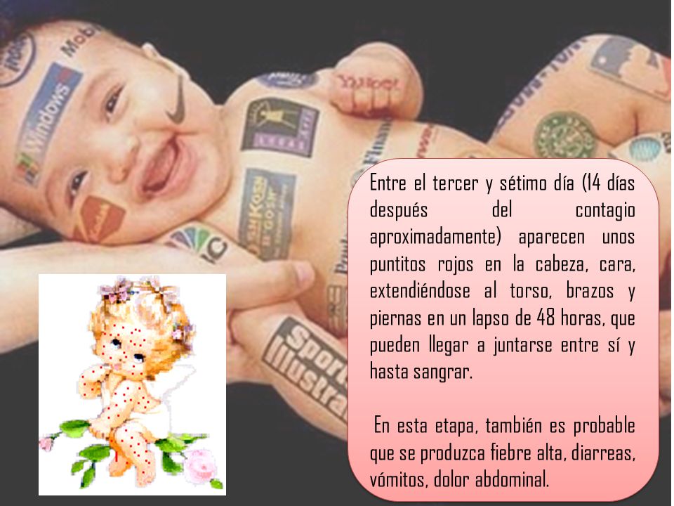 Entre el tercer y sétimo día (14 días después del contagio aproximadamente) aparecen unos puntitos rojos en la cabeza, cara, extendiéndose al torso, brazos y piernas en un lapso de 48 horas, que pueden llegar a juntarse entre sí y hasta sangrar.