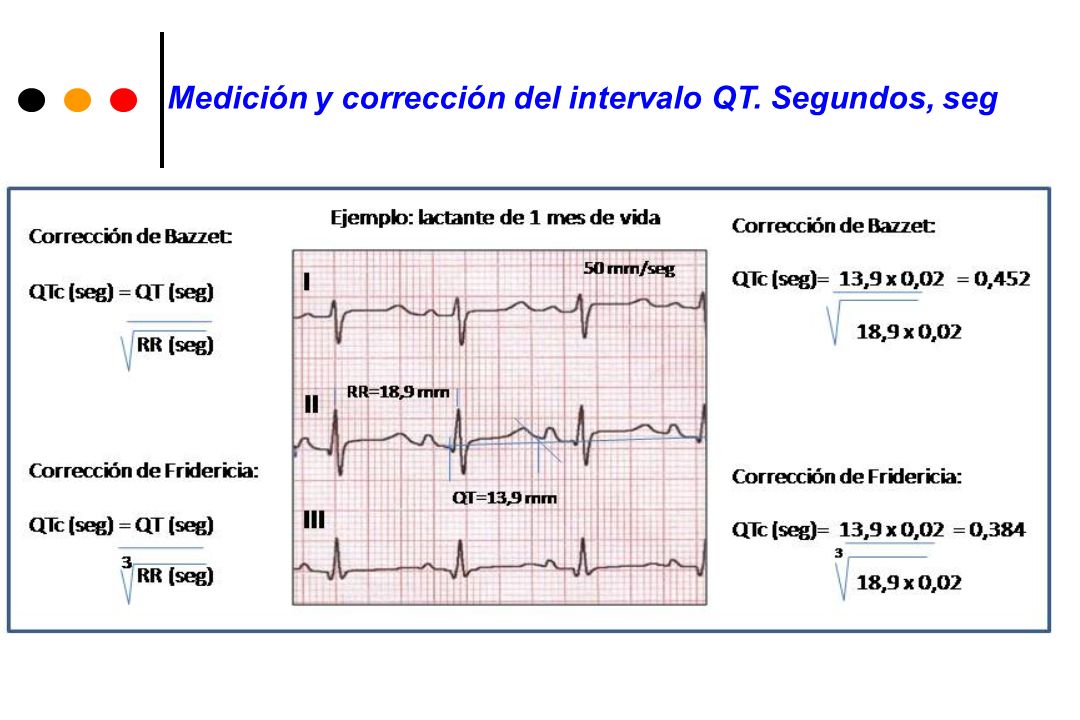Medición y corrección del intervalo QT. Segundos, seg