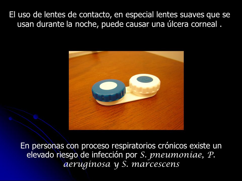 El uso de lentes de contacto, en especial lentes suaves que se usan durante la noche, puede causar una úlcera corneal .