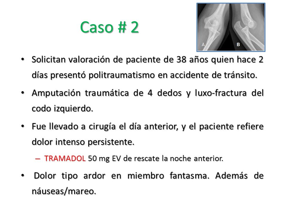 Caso # 2 Solicitan valoración de paciente de 38 años quien hace 2 días presentó politraumatismo en accidente de tránsito.