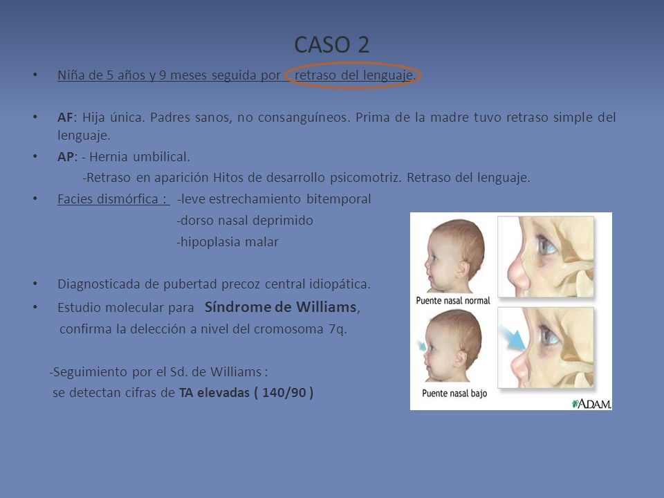 CASO 2 Niña de 5 años y 9 meses seguida por retraso del lenguaje.