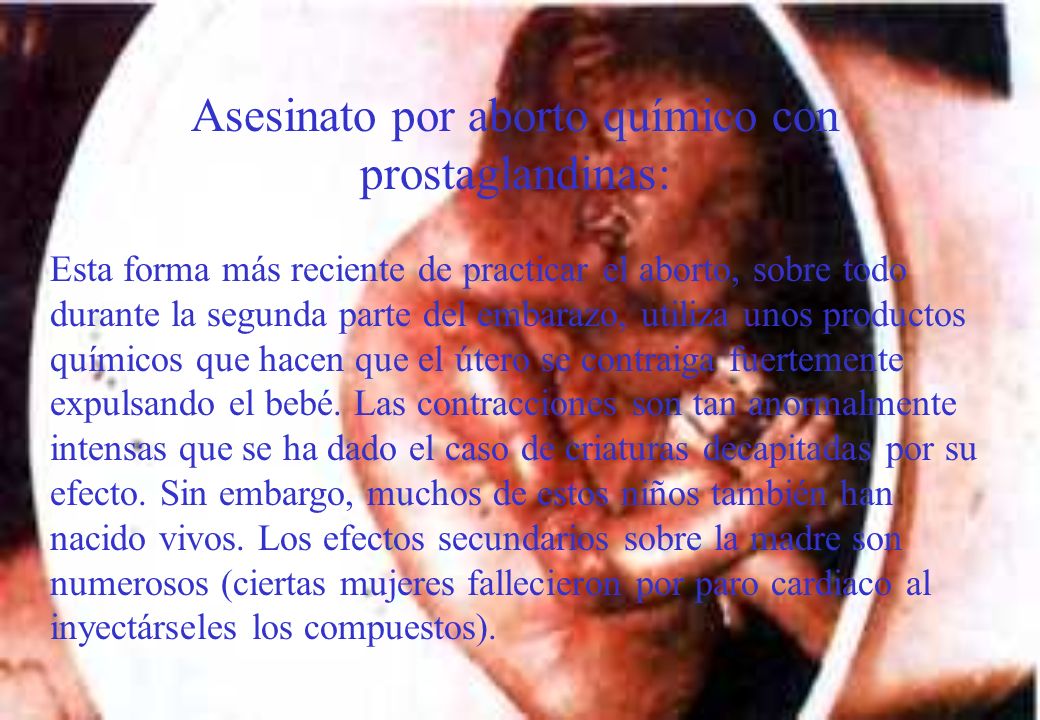 Asesinato por aborto químico con prostaglandinas: