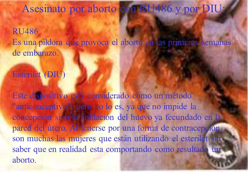 Asesinato por aborto con RU486 y por DIU: