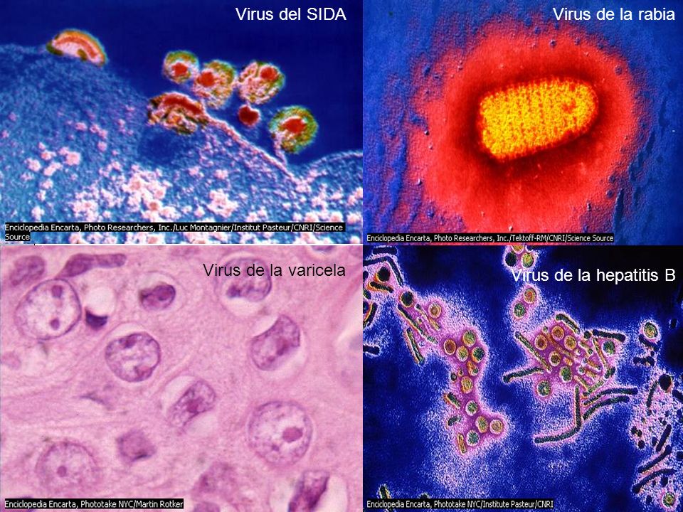 Virus del SIDA Virus de la rabia Virus de la varicela Virus de la hepatitis B