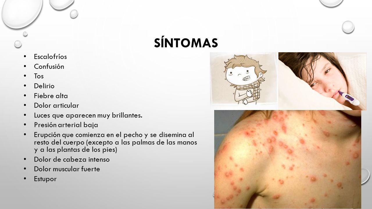 Síntomas Escalofríos Confusión Tos Delirio Fiebre alta Dolor articular