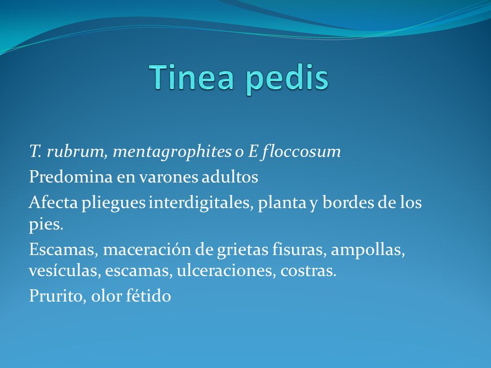 Tinea pedis T. rubrum, mentagrophites o E floccosum