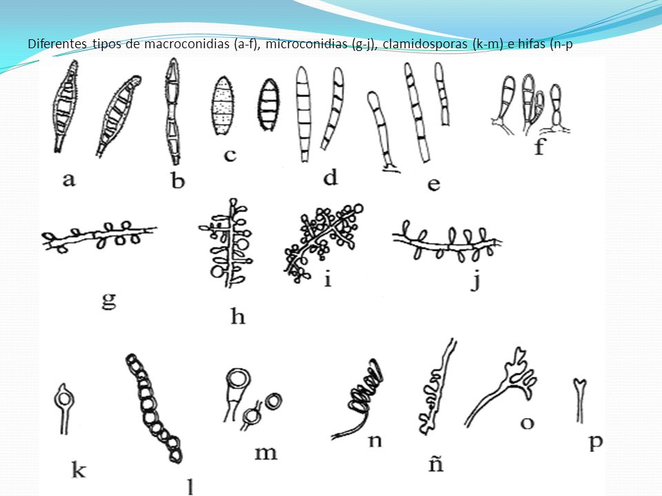 Diferentes tipos de macroconidias (a-f), microconidias (g-j), clamidosporas (k-m) e hifas (n-p