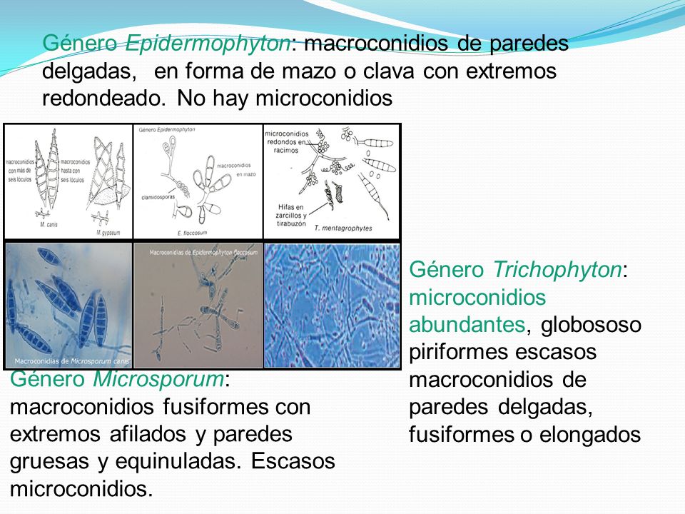 Género Epidermophyton: macroconidios de paredes delgadas, en forma de mazo o clava con extremos redondeado. No hay microconidios