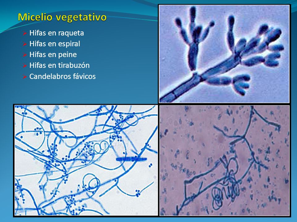 Micelio vegetativo Hifas en raqueta Hifas en espiral Hifas en peine