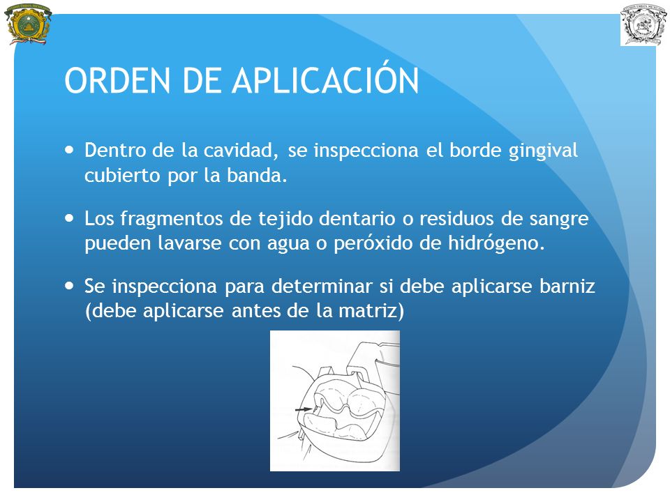 ORDEN DE APLICACIÓN Dentro de la cavidad, se inspecciona el borde gingival cubierto por la banda.