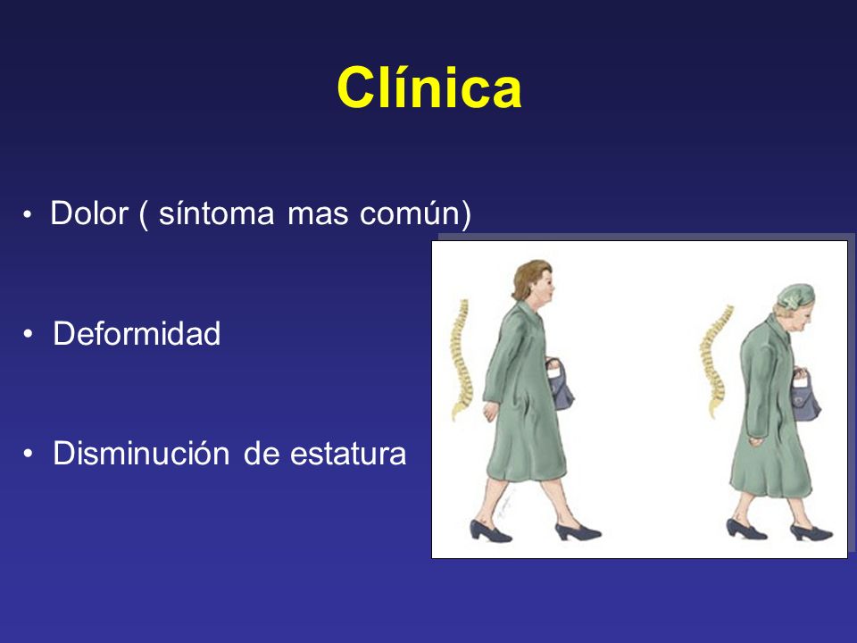 Clínica Dolor ( síntoma mas común) Deformidad Disminución de estatura