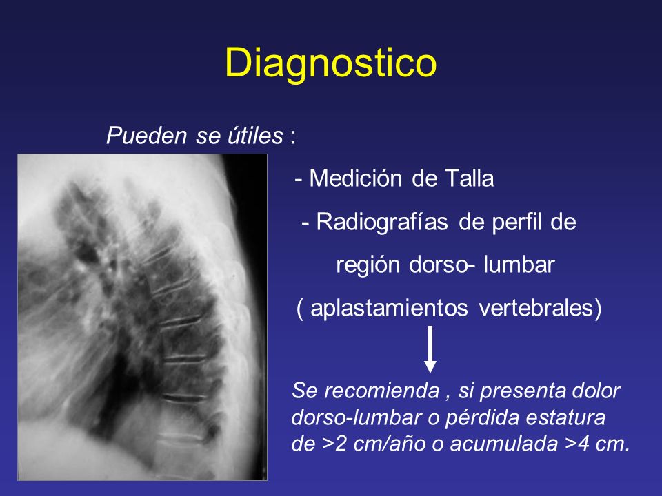 Diagnostico - Medición de Talla - Radiografías de perfil de