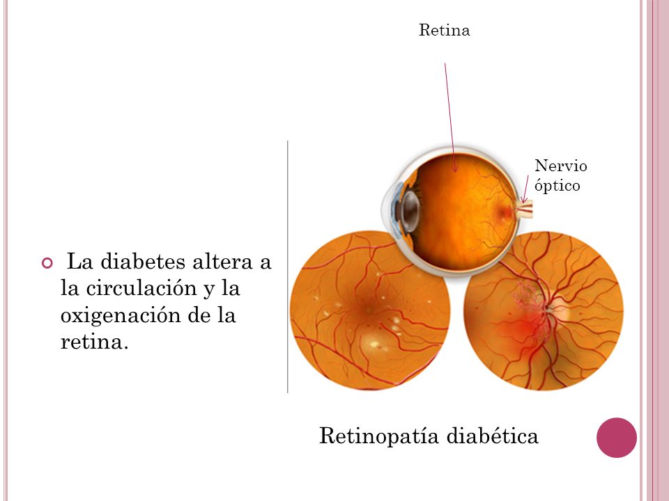 La diabetes altera a la circulación y la oxigenación de la retina.