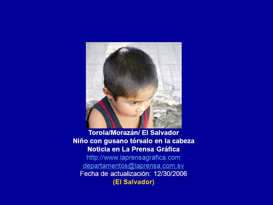 Torola/Morazán/ El Salvador Niño con gusano tórsalo en la cabeza