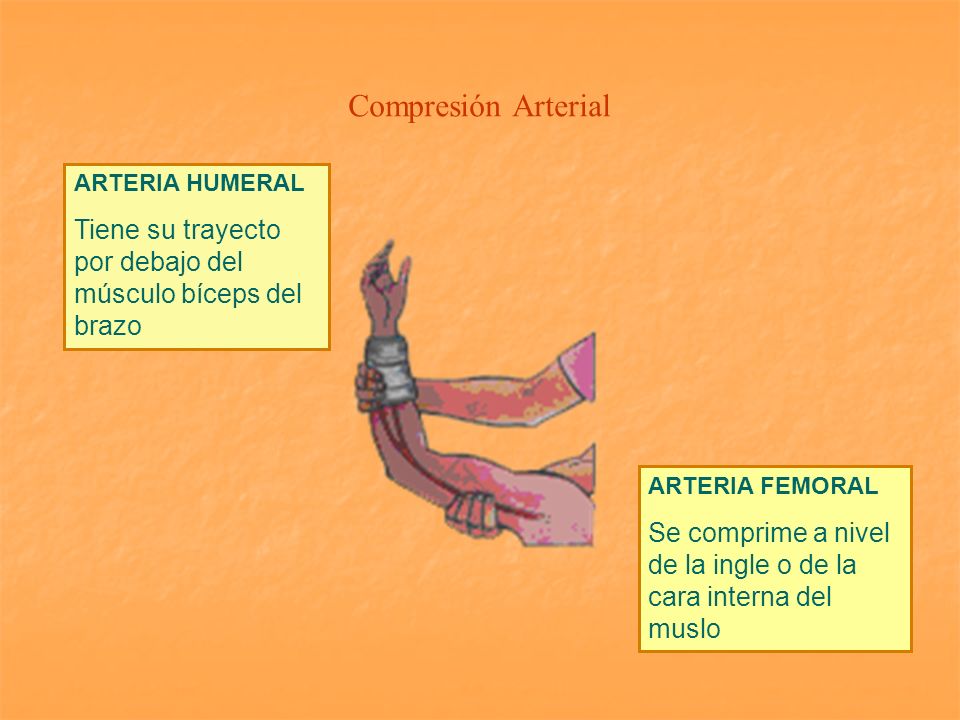 Compresión Arterial ARTERIA HUMERAL. Tiene su trayecto por debajo del músculo bíceps del brazo. ARTERIA FEMORAL.