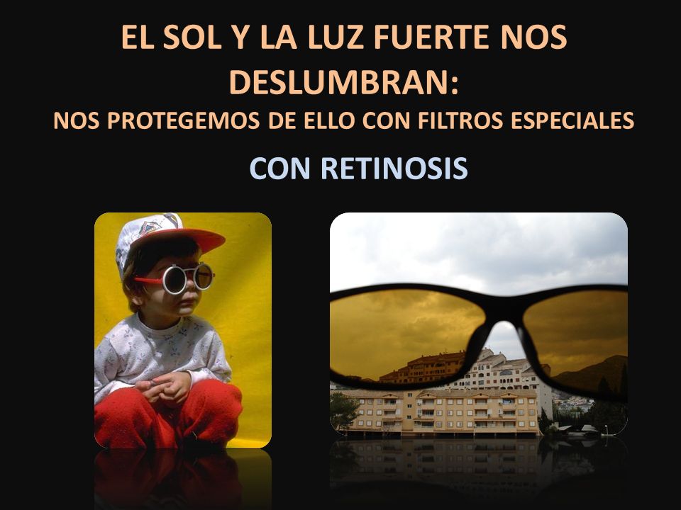 EL SOL Y LA LUZ FUERTE NOS DESLUMBRAN: NOS PROTEGEMOS DE ELLO CON FILTROS ESPECIALES
