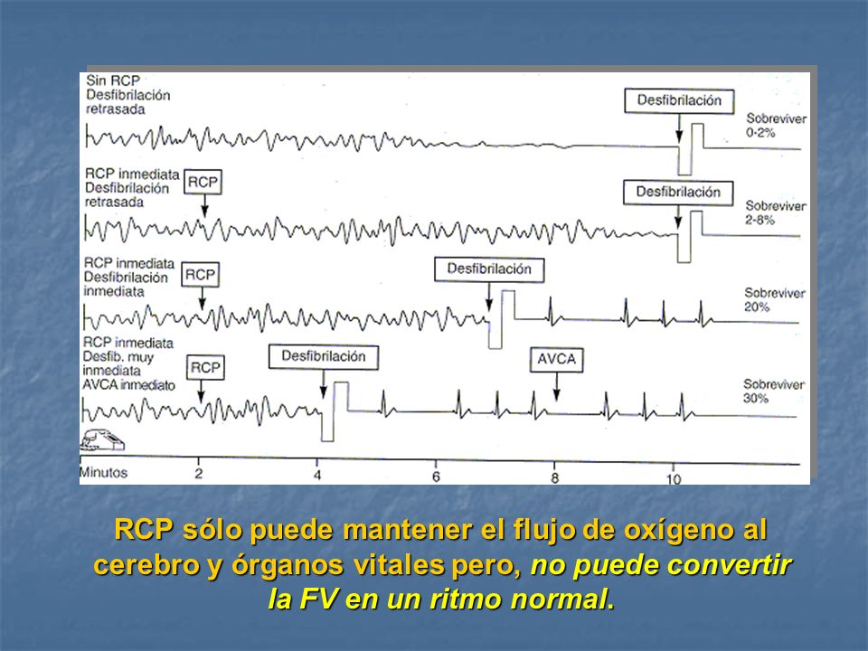 RCP sólo puede mantener el flujo de oxígeno al cerebro y órganos vitales pero, no puede convertir la FV en un ritmo normal.