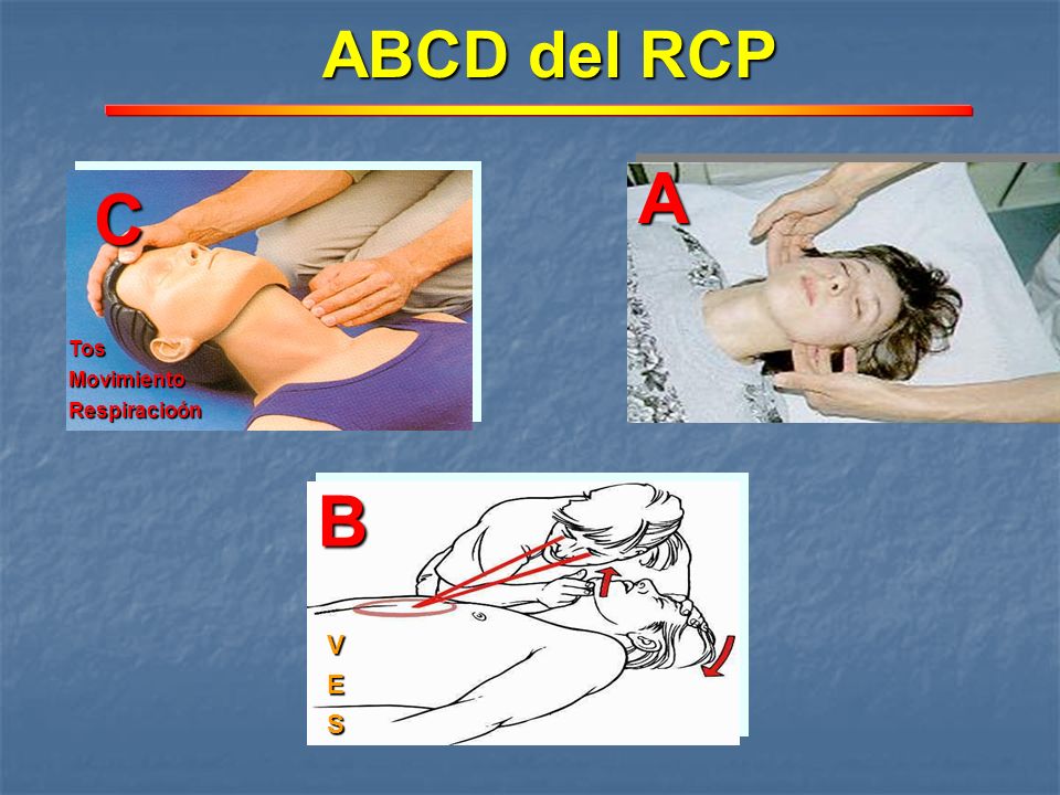 ABCD del RCP A C Tos Movimiento Respiracioón B V E S