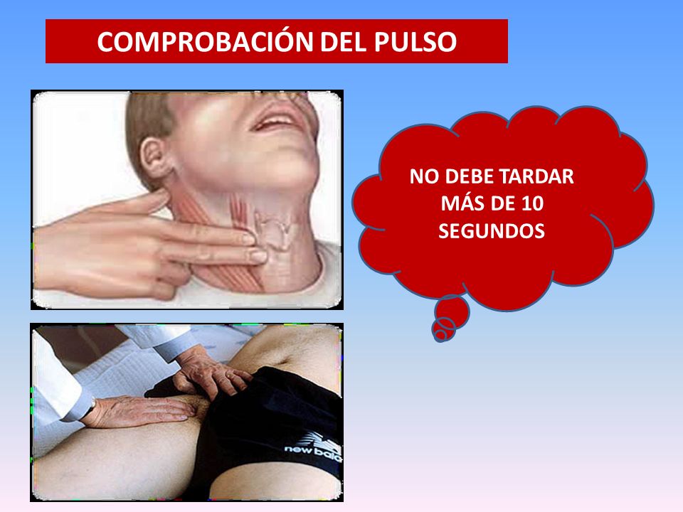 COMPROBACIÓN DEL PULSO NO DEBE TARDAR MÁS DE 10 SEGUNDOS