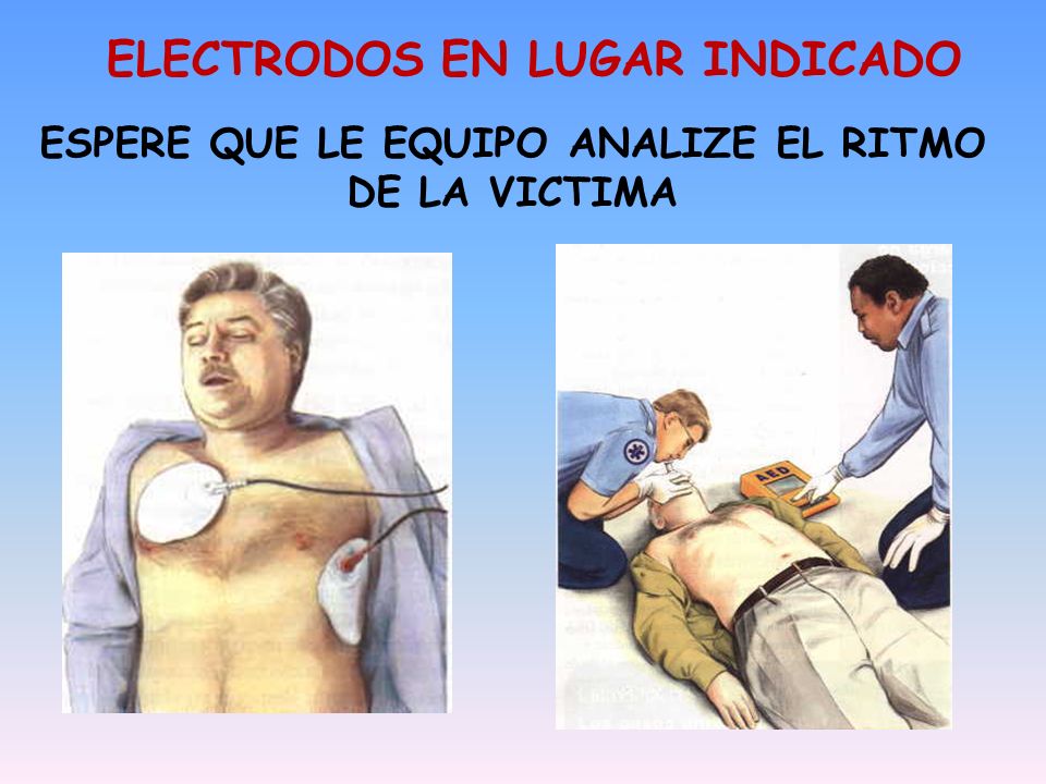 ESPERE QUE LE EQUIPO ANALIZE EL RITMO DE LA VICTIMA