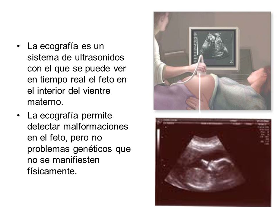 La ecografía es un sistema de ultrasonidos con el que se puede ver en tiempo real el feto en el interior del vientre materno.