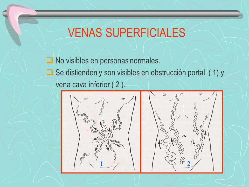 VENAS SUPERFICIALES No visibles en personas normales.